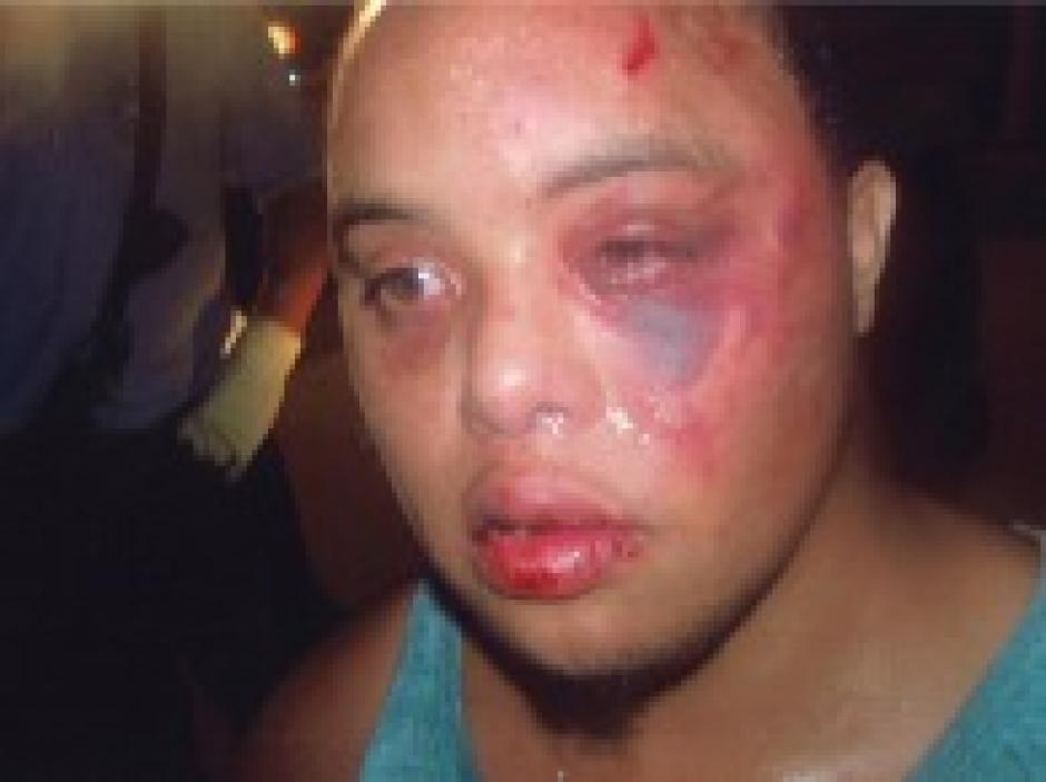 police_assualts_man_with_down-syndrome (1)