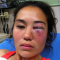 St. Louis Woman Falsely Filed Knockout Game Attack Police Report
