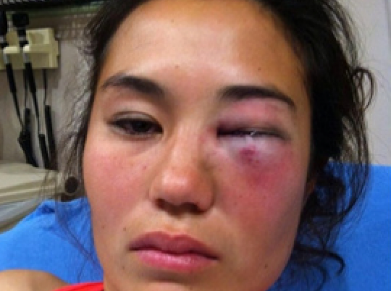 ashley-depew-knockout-game-st-louis-lie (1)